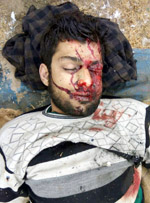 Dead body of top LeT commander Abu Musaib.