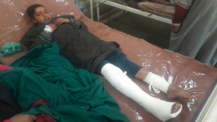 A child injured in Sopore blast on Sunday. —Excelsior/Aabid Nabi