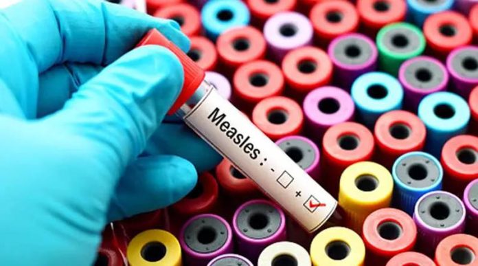 91 pc of Sri Lankan children vaccinated against measles